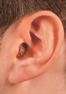 COMPLETELY IN THE CANAL (CIC)Hearing Aid